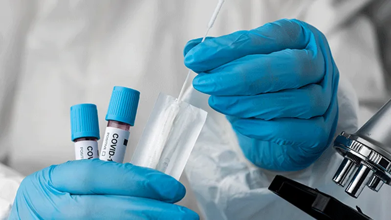 NCDC covid 19 test centers in nigeria