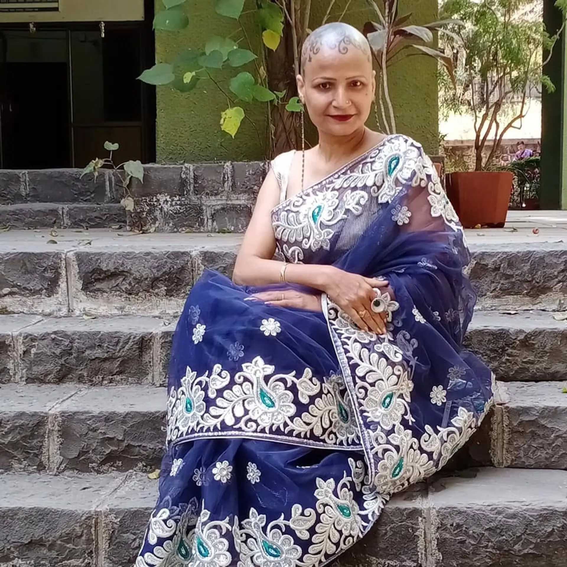 सुंदरता आत्मा में है, बालों में नहीं! मिलिए केतकी जानी से, जिन्होंने एलोपेशिया को मात देकर जीता मिसेज इंडिया वर्ल्डवाइड का खिताब