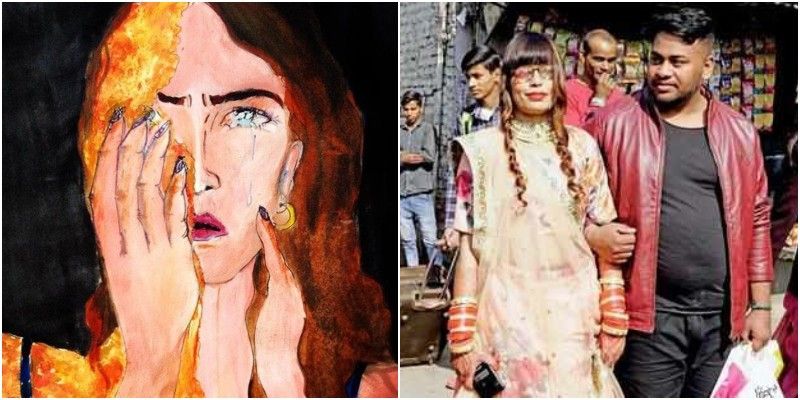 एसिड अटैक: 19 साल की उम्र में खत्म हो गई थी जीने की उम्मीद, फेसबुक से मिले शख्स से की शादी 