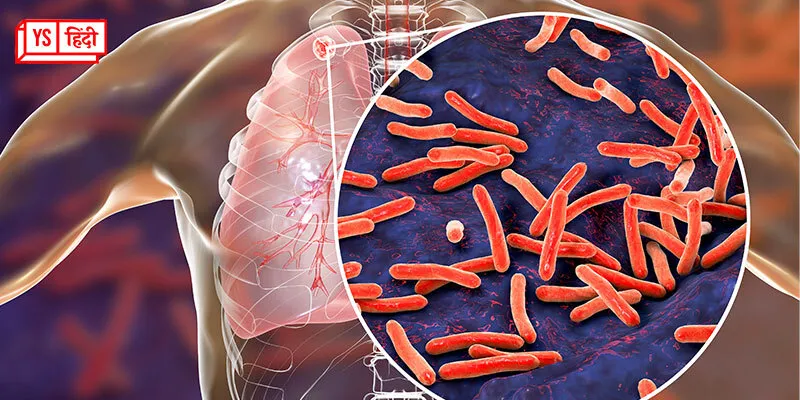 tuberculosis deaths and disease increase during the covid-19 pandemic who report