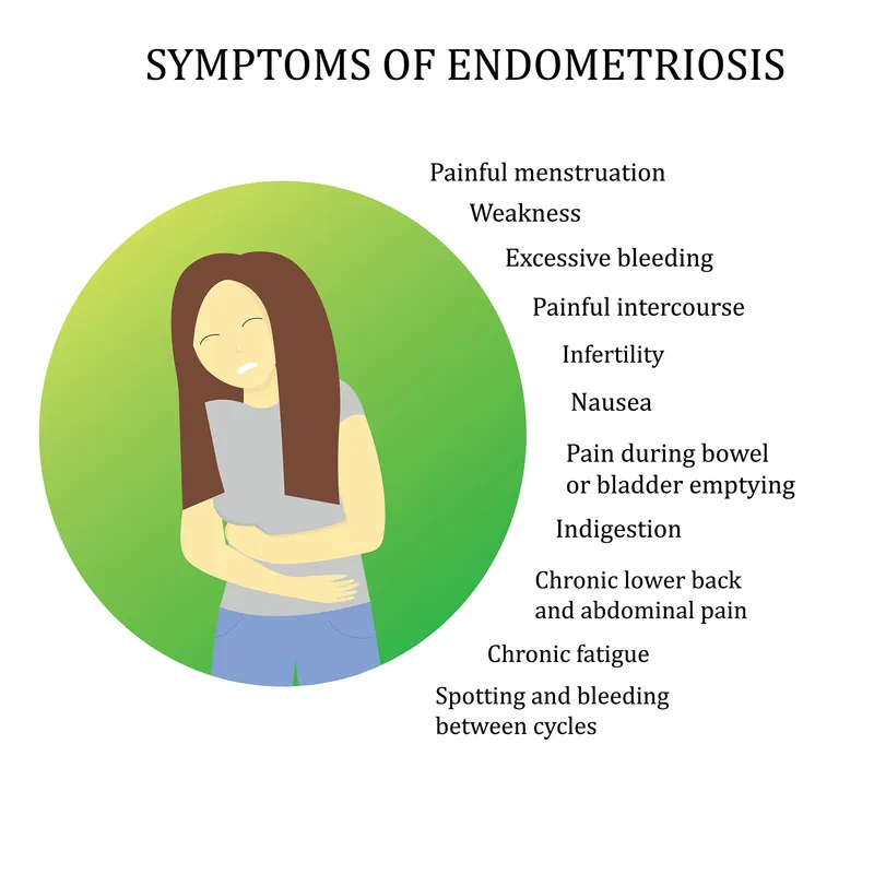 Endometriosis symptoms