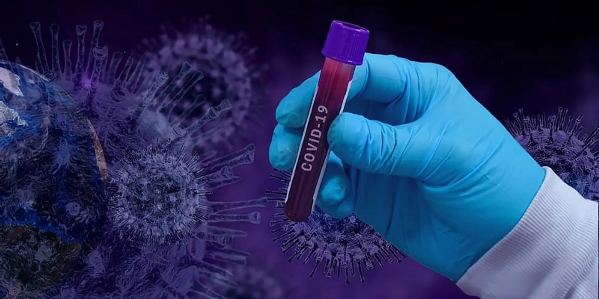 Bharat Biotech inks pact with Precisa Medicamentos to supply Covaxin to Brazil