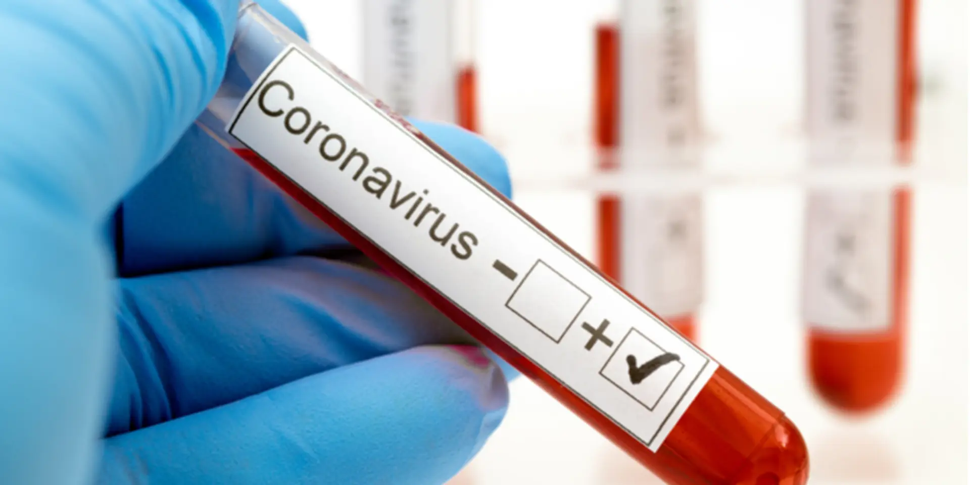 Mfine sets up AI tool to help doctors and patients check COVID-19 without stepping out