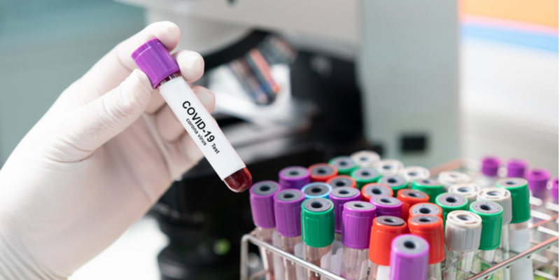 Coronavirus: What are the challenges around COVID-19 testing in India?