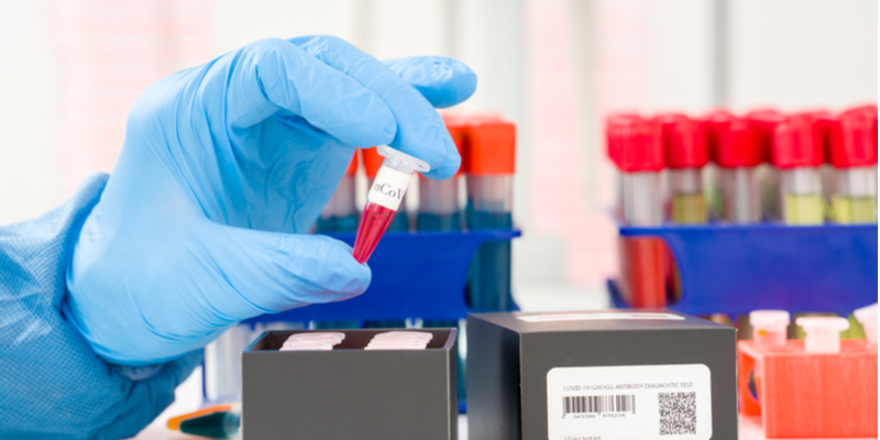 PepsiCo India-funded COVID-19 testing kits start reaching laboratories