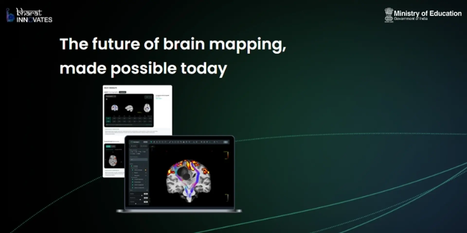 The Bengaluru startup using AI to bring precision to brain and mental health care