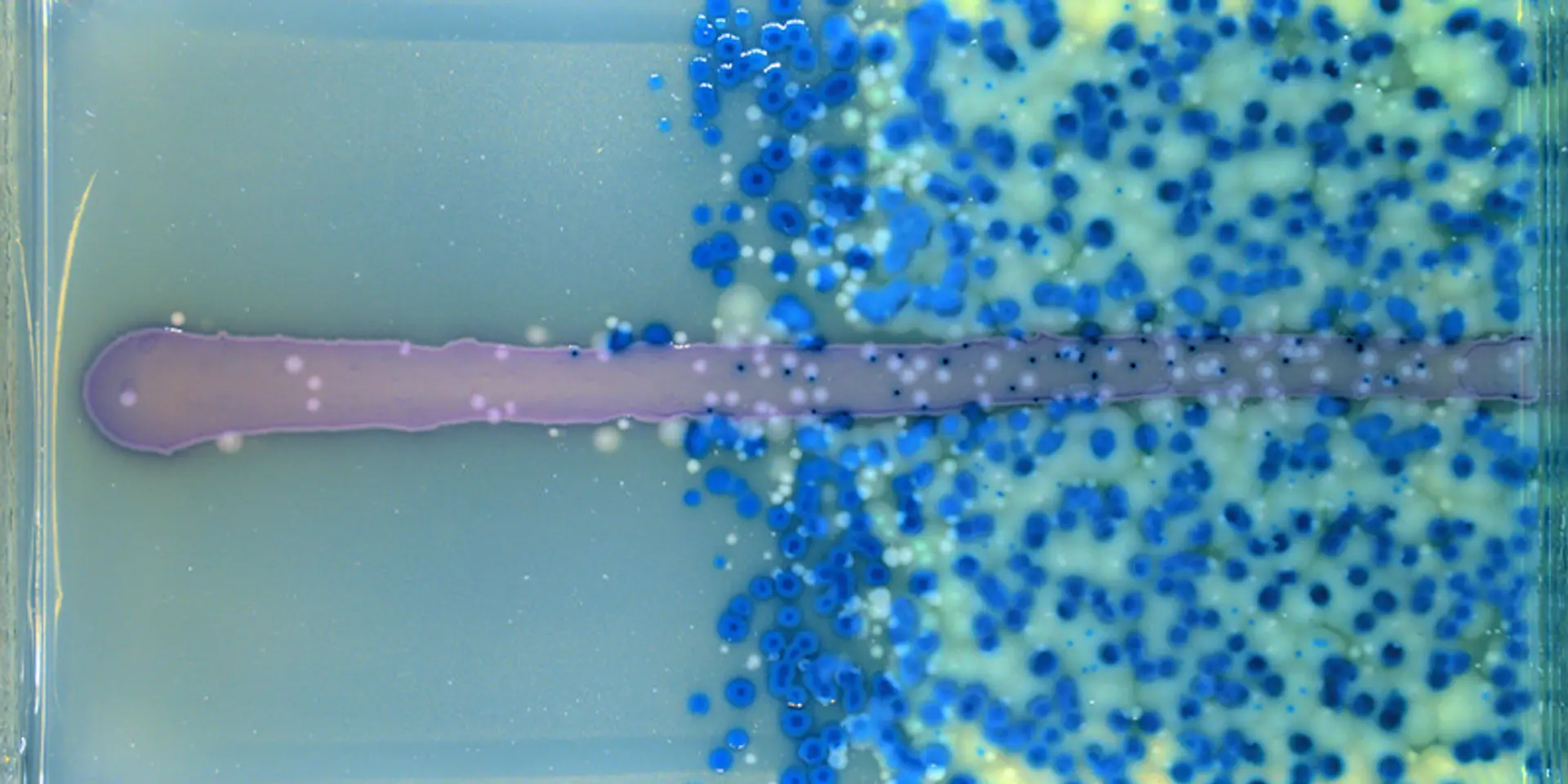 Why the silent pandemic of antimicrobial resistance needs collective action