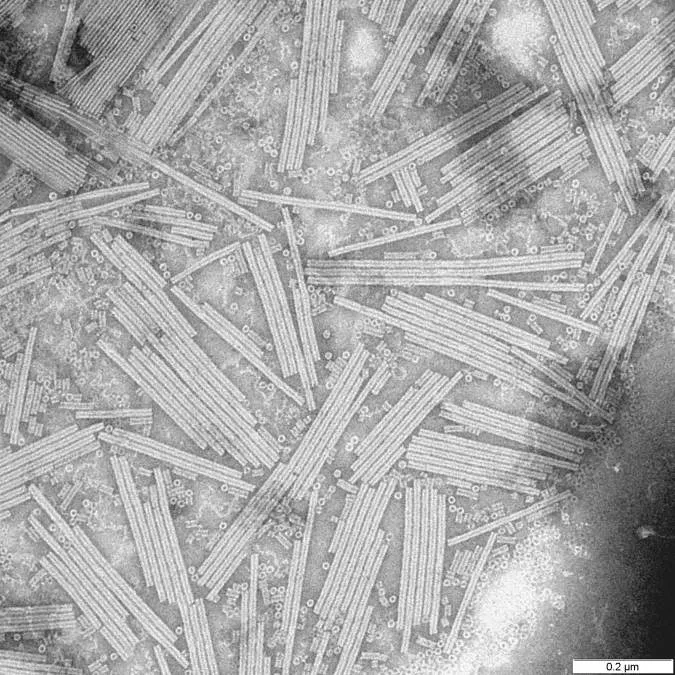 An electron micrograph of Tobacco Mosaic Virus; Wikimedia Commons, Public Domain