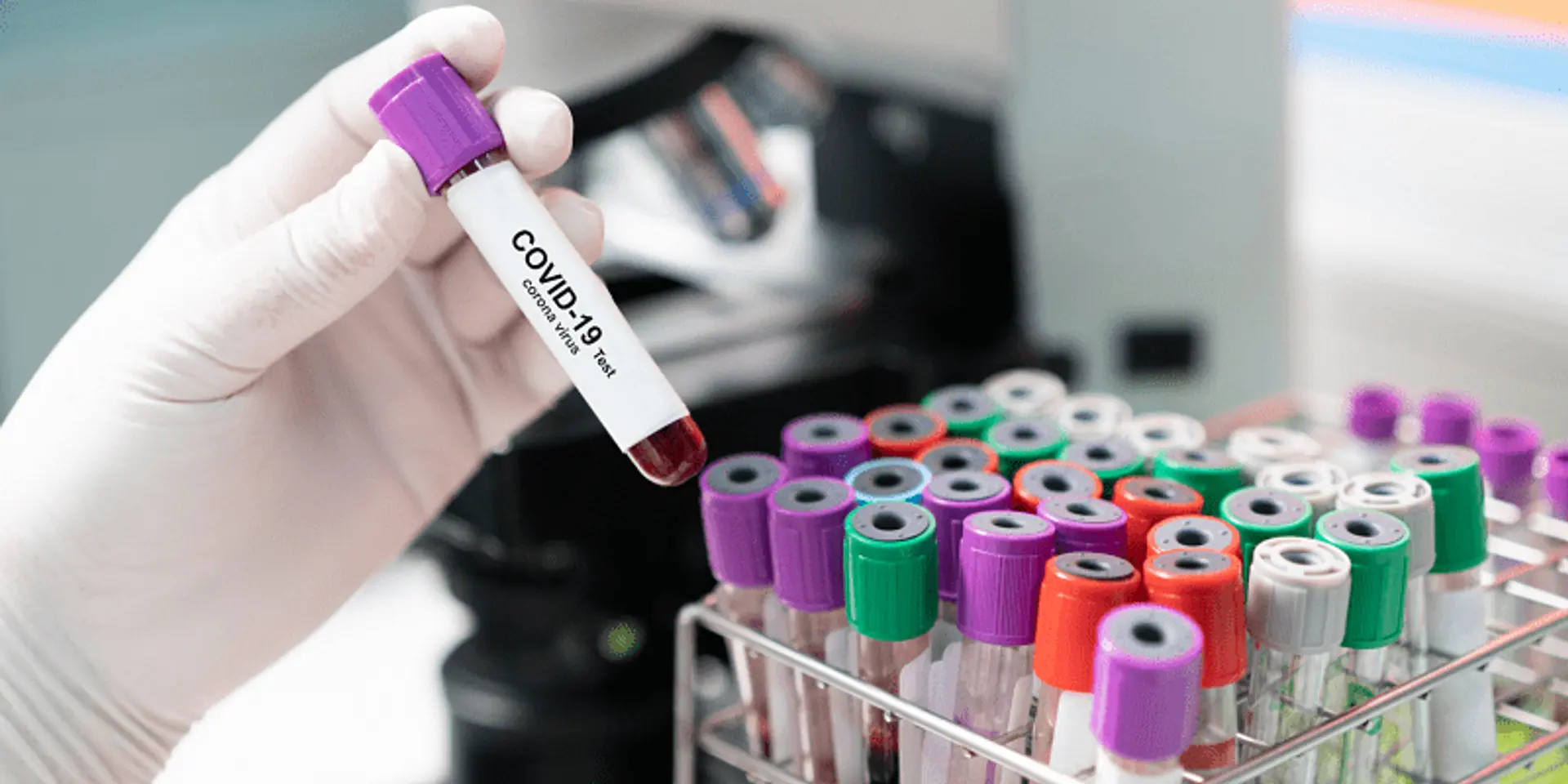 C-CAMP gets Rs 12 Cr grant from Novo Nordisk Foundation to mitigate COVID-19 bed crisis