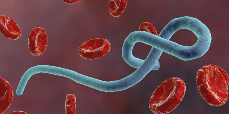 Ebola