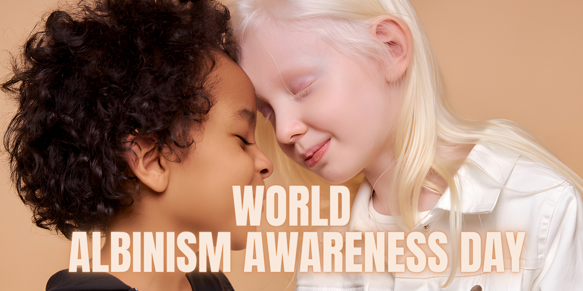 Shining a Light on Albinism: World Albinism Awareness Day