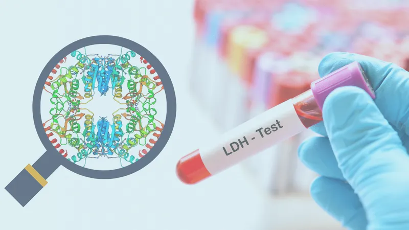 LDH
