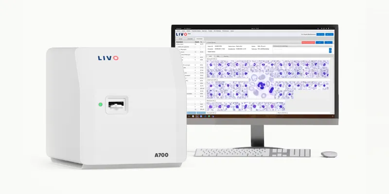 Livo.ai