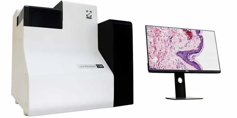 Continuum 120, Morphle