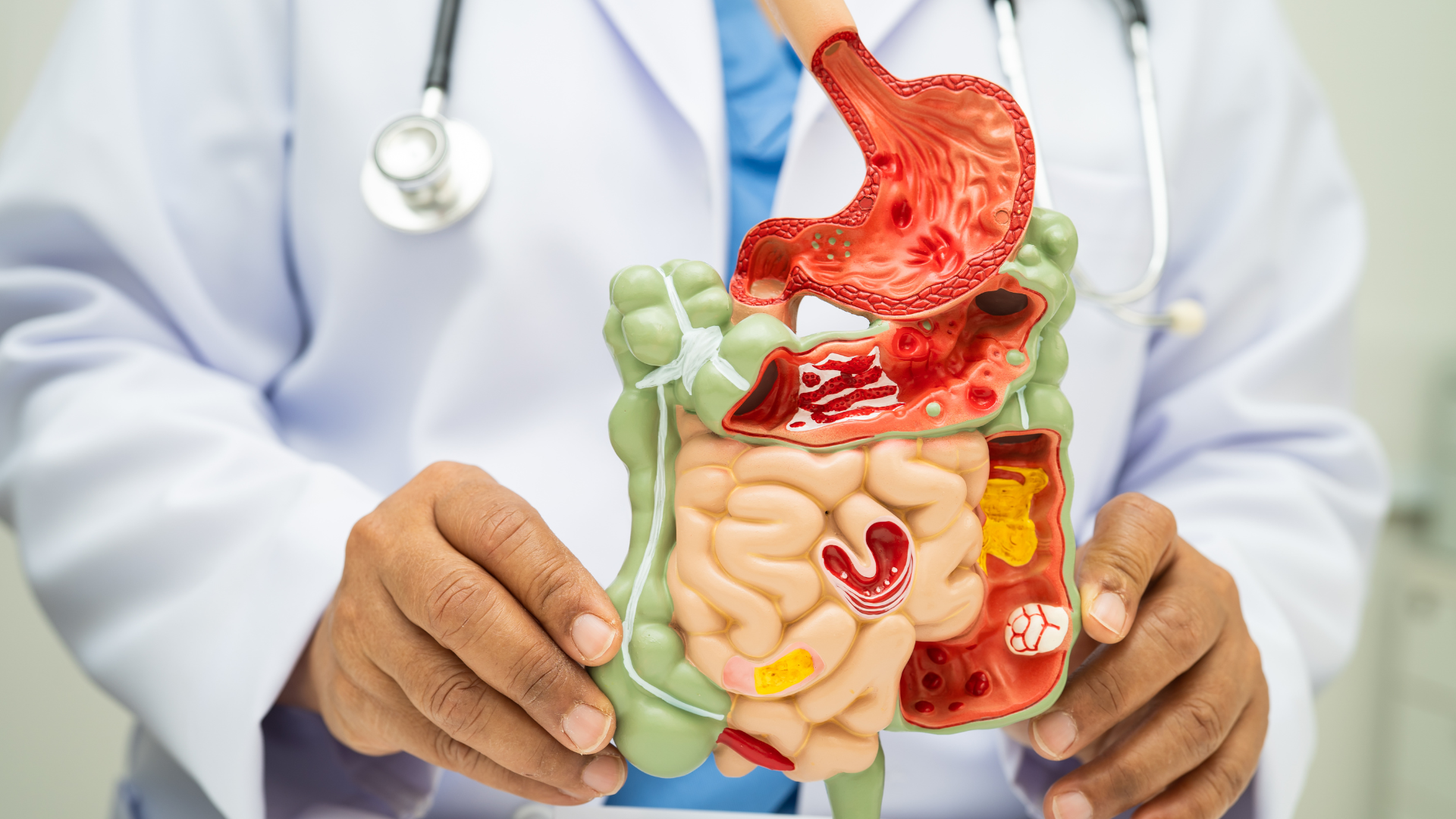 5 simple ways to improve your gut health naturally