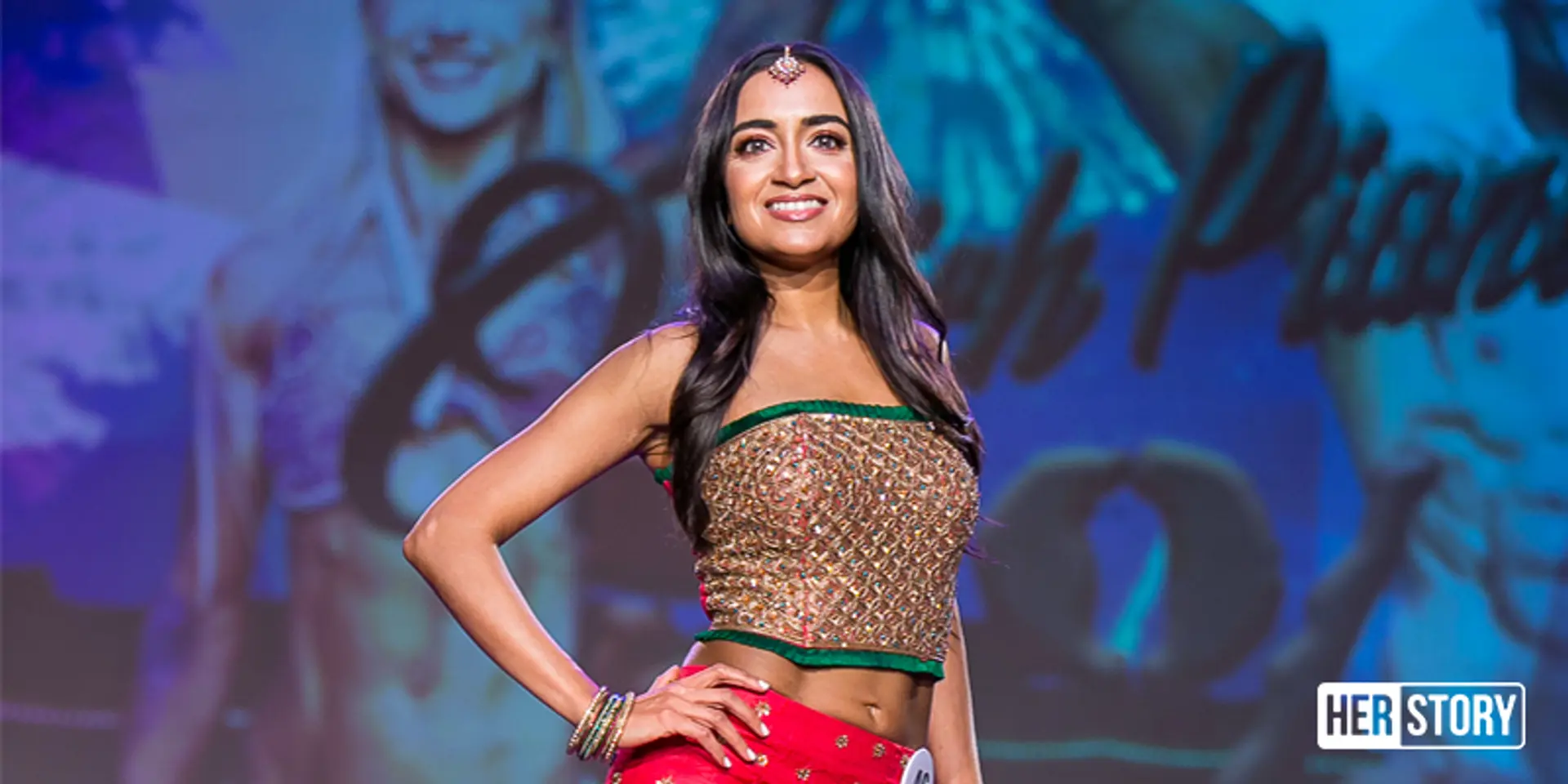 Meet the model and woman entrepreneur who wants to remove the stigma surrounding vitiligo