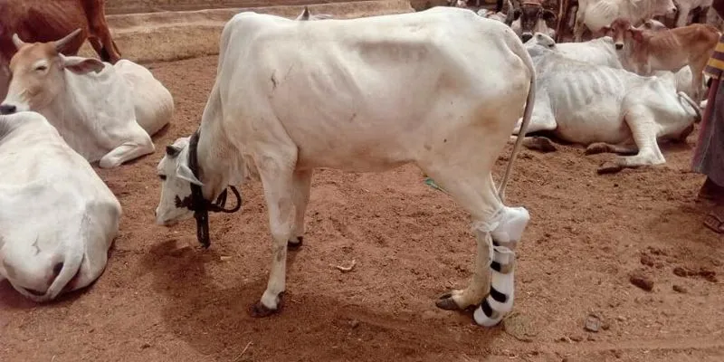 Artificial limbs
