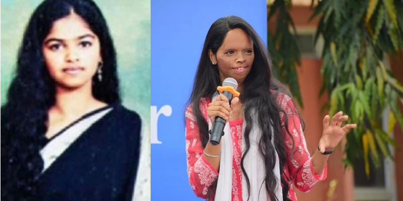 Laxmi Agarwal’s story and how this Acid Attack Survivor has not just inspired Deepika Padukone, but millions of other Indians