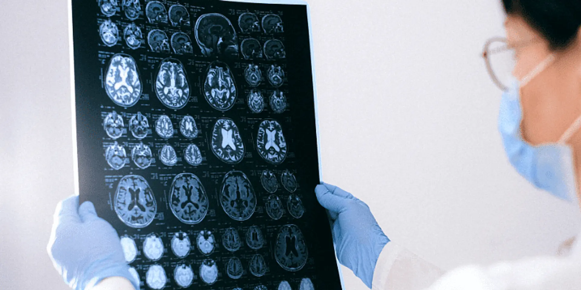 How Artificial Intelligence is revolutionising respiratory care