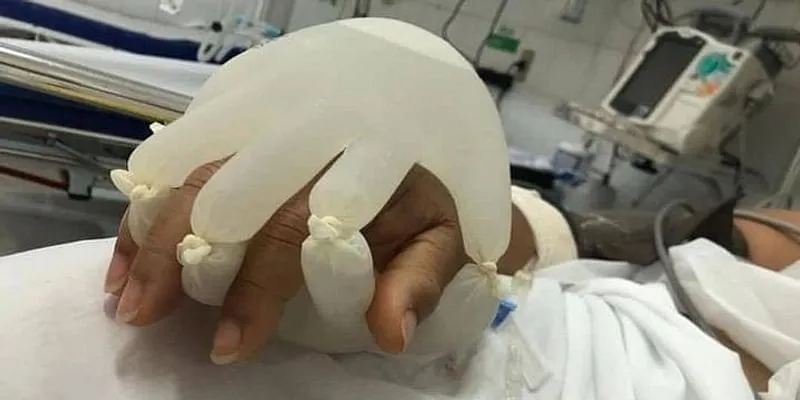Brazilian nurses use gloves to provide a sense of human touch to COVID-19 patients in isolation - Vimarsana News
