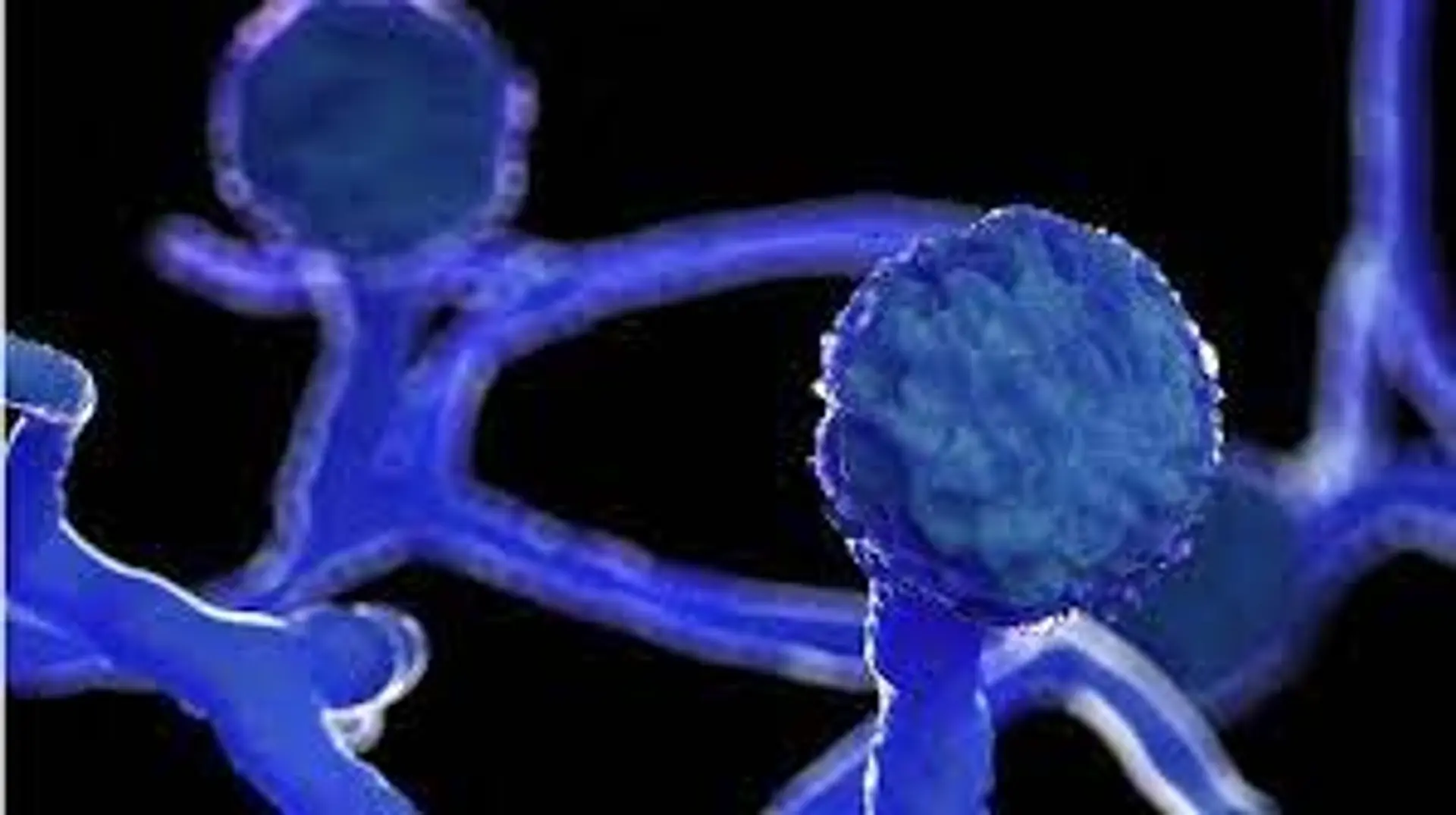 COVID-19: Patients hit by rare 'black fungus'