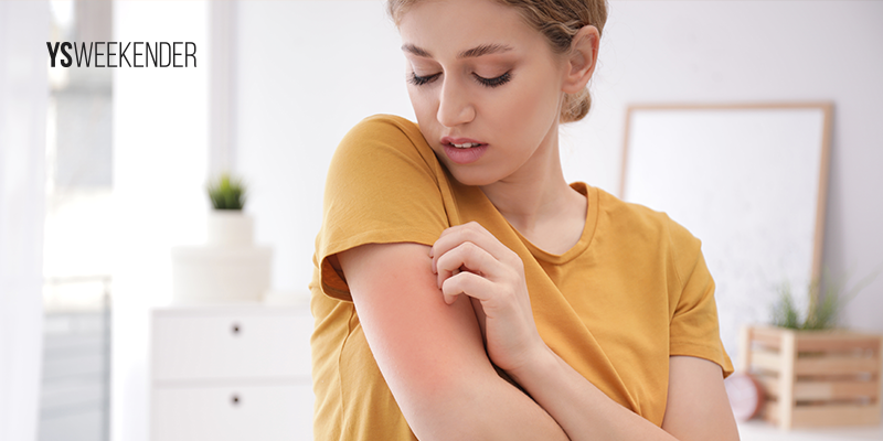 Are food allergies becoming very common today?