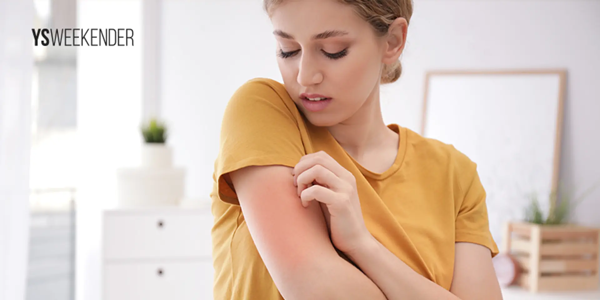 Are food allergies becoming very common today?