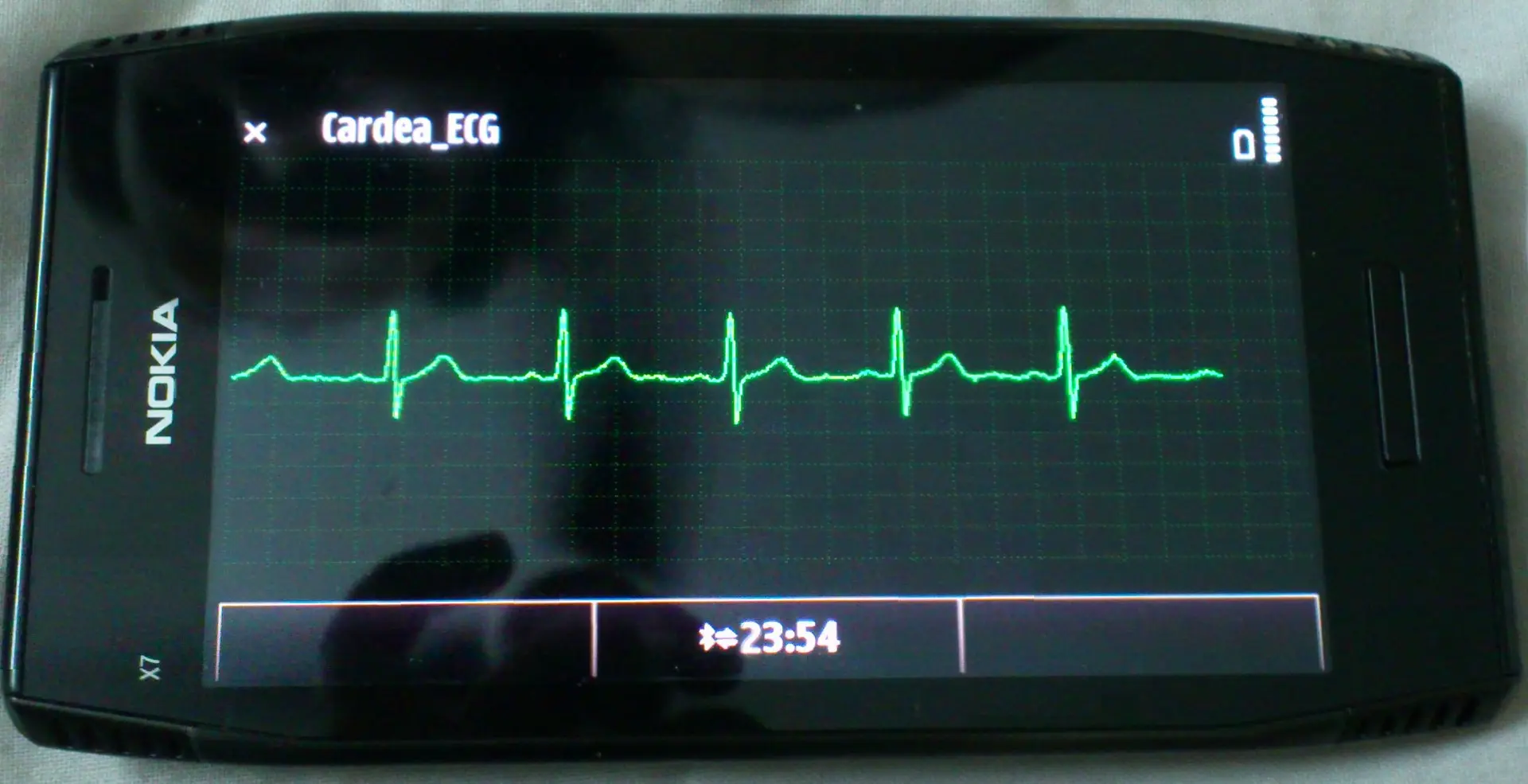 Cardea Biomedical to launch a device to get ECG readings on mobile