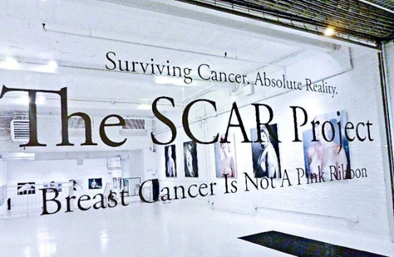 The SCAR Project, where breast cancer is more than just a pink ribbon