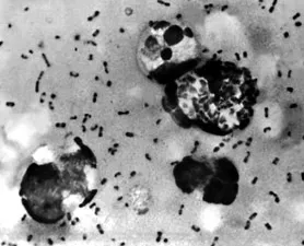 Y Pestis, the bacteria responsible for the black death