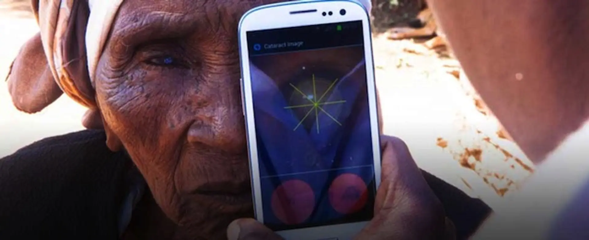 Rise of self-diagnostics: Your smartphone can be as smart as your doctor