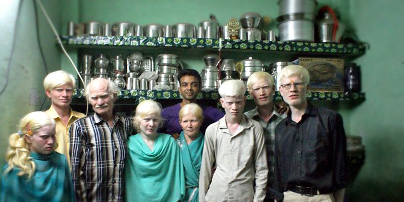 Empowering transgenders, albinos and more – Anubhav Gupta’s vision