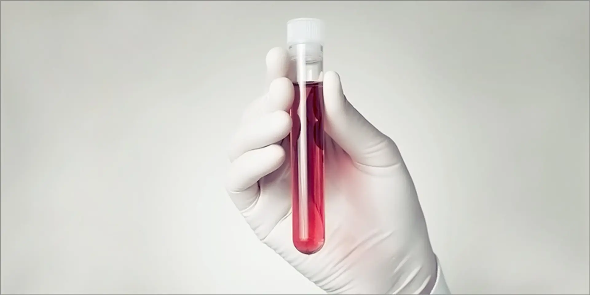 Started by IIT Delhi alumni, pathology test marketplace Labstreet plans presence in 10 cities