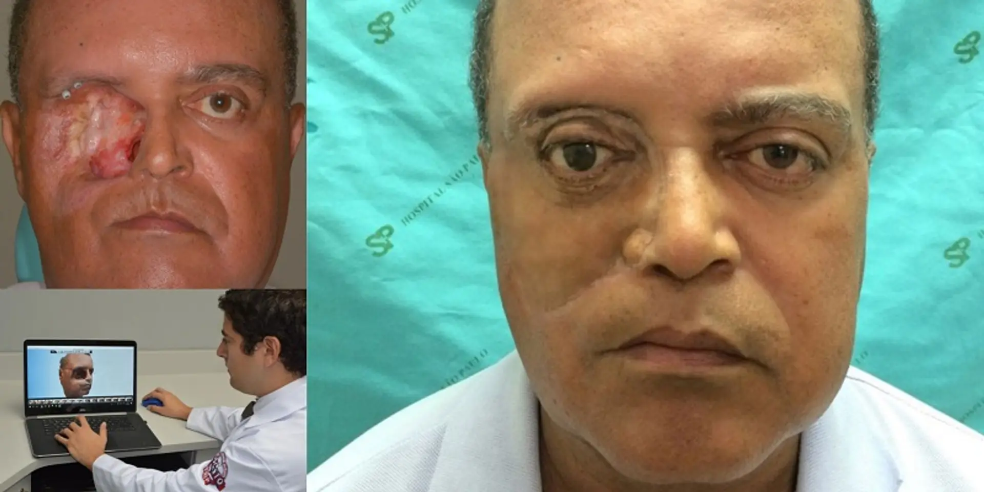 When doctors used a smartphone to give this cancer survivor the world’s first 3D-printed face