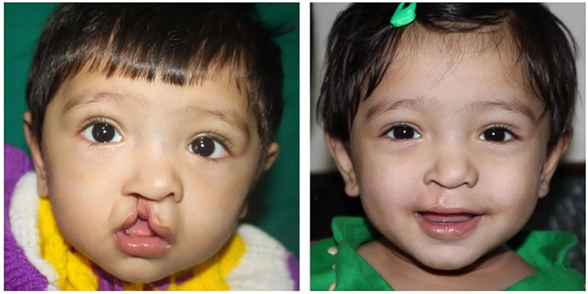 This organisation is changing the world for little children, one smile at a time