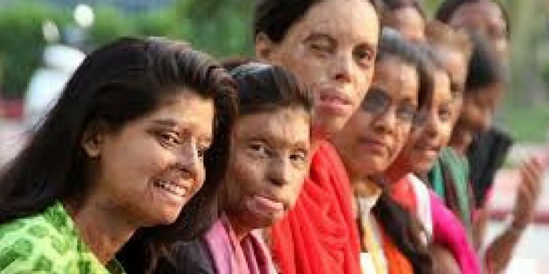 Delhi University reserves seats for acid-attack survivors this year onward