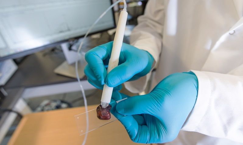 This 'pen' can identify cancer in 10 seconds