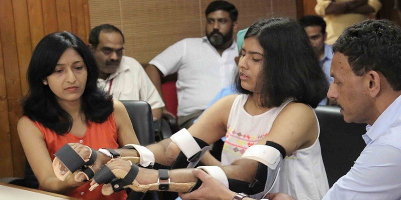 India's first such transplant gives 19-year-old her hands back