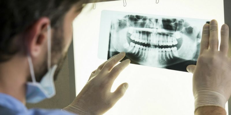 Alzheimer's drug could be key to tooth repair, revolutionising dental treatments