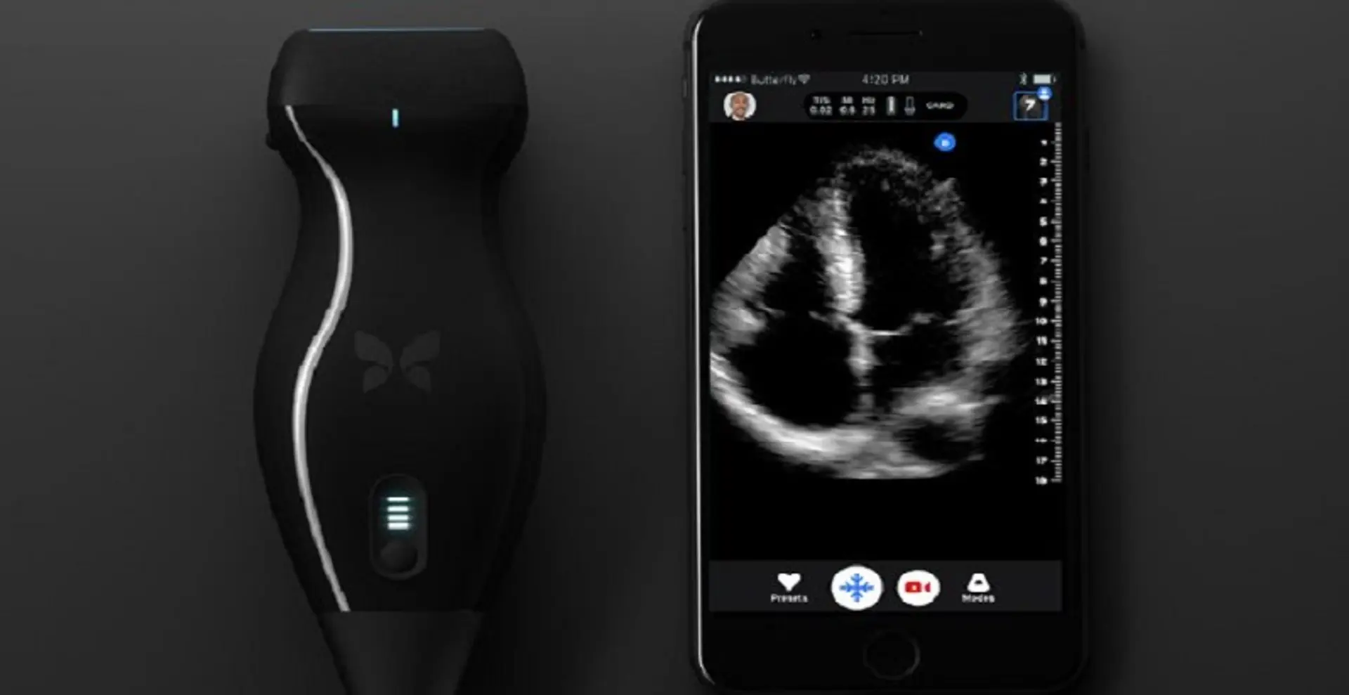 This iPhone-based ultrasound machine can detect cancer