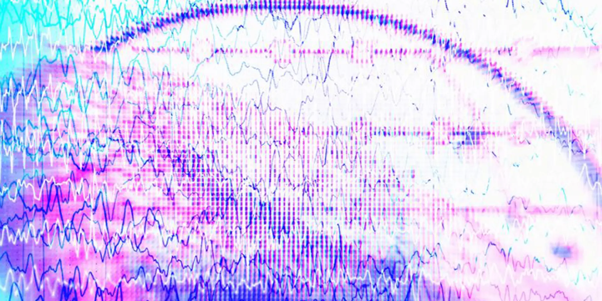 By predicting seizures, AI could be a life-changer for people with epilepsy