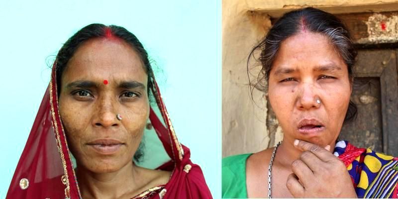 When women are branded witches - Vimarsana News