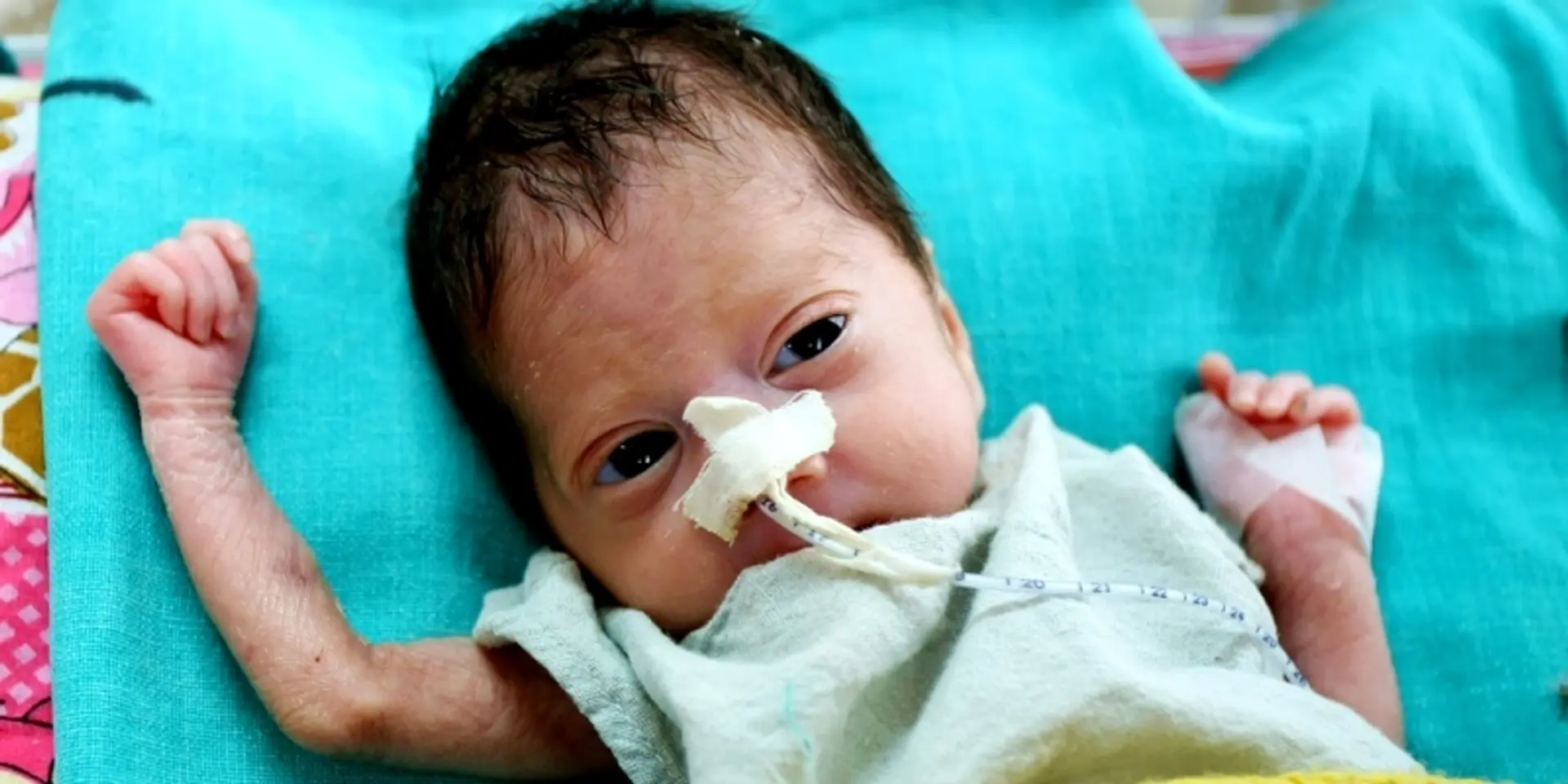 Rare diseases are not so rare – why India needs better public health policies