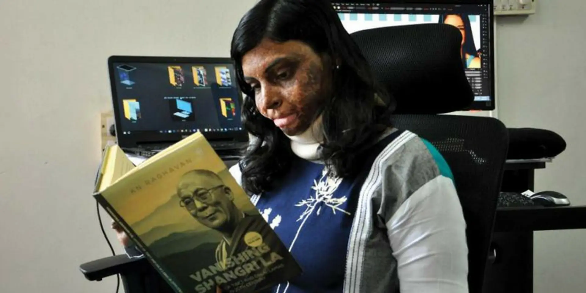 Meet Nihari Mandali, the burn survivor who started an NGO for other burn-attack victims