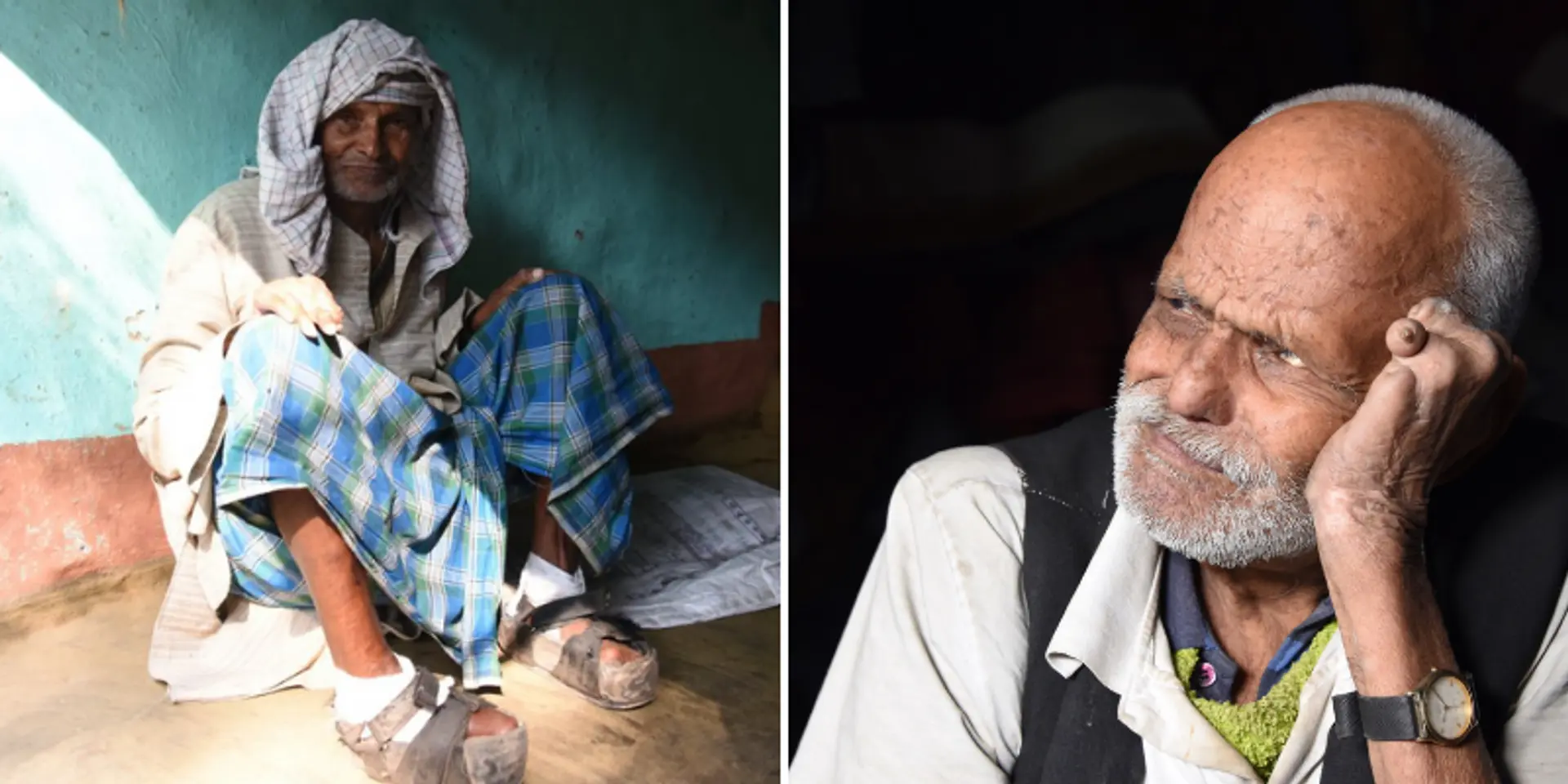World Leprosy Day: what the Indian government is doing to achieve its goal of a leprosy-free India