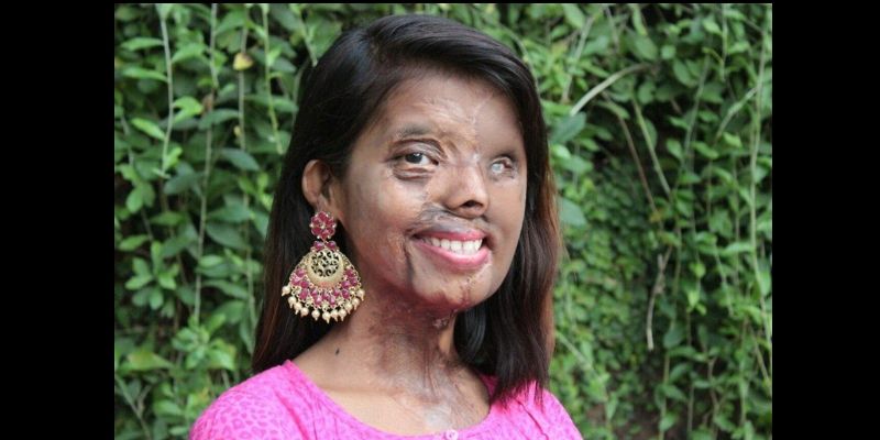 Meet acid attack survivor Anmol Rodriguez who has fashioned a better world for herself and others like her