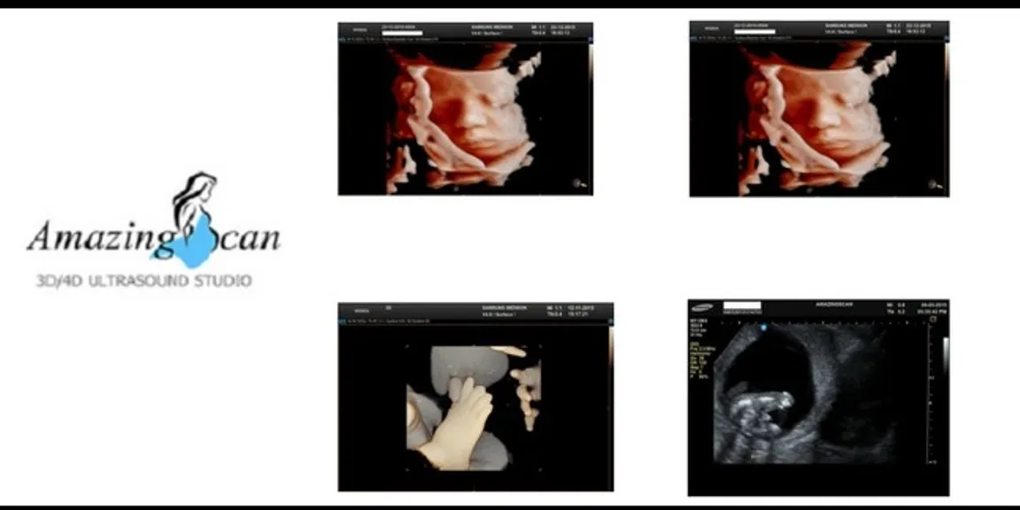 How Important is 3d 4d Ultrasound during Pregnancy?