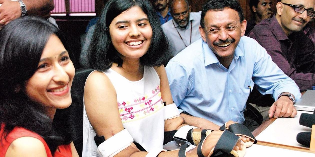 भारत के डॉक्टरों का कारनामा, एशिया में पहली बार ट्रांसप्लांट किया लड़की का हाथ