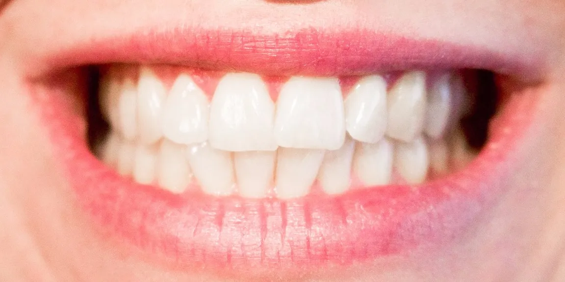 Restoring Your Smile After Complete Tooth Loss