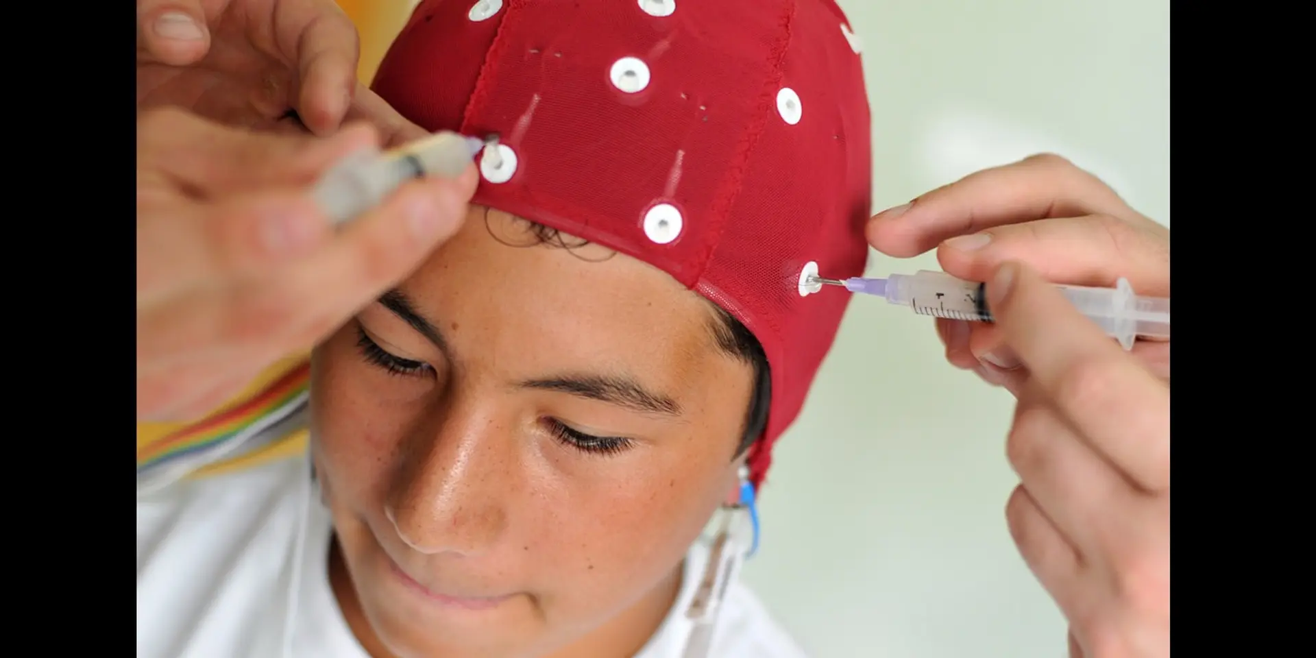Expert’s answers to all your concussion-related questions